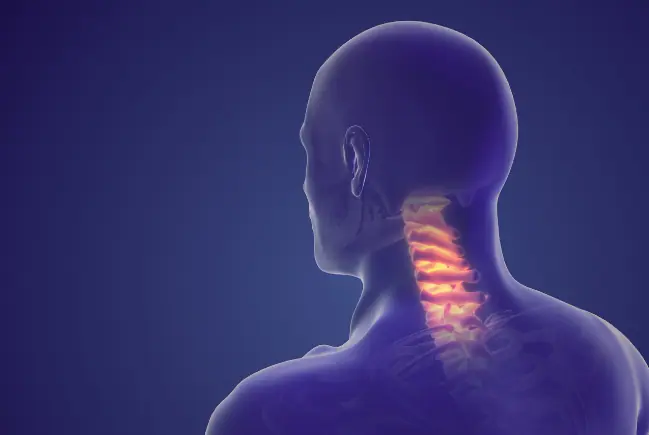Cervicalgia al collo
